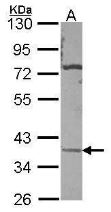 ATPase Na+/K+ transporting subunit beta 3 Antibody