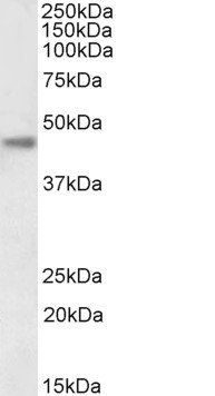 Goat anti-carbonic anhydrase XII (aa188-199), Biotinylated Antibody