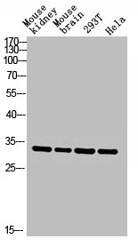 CA2 Antibody