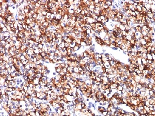 CA9 Antibody