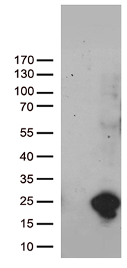 CABLES1 Antibody