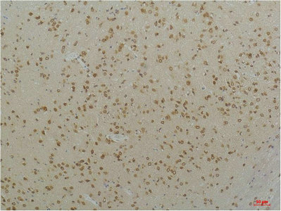 CACNA1C Antibody