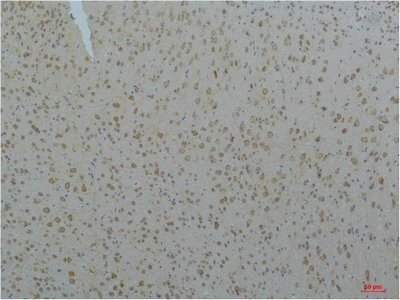 CACNA1C Antibody