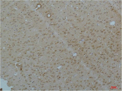 CACNA1C Antibody