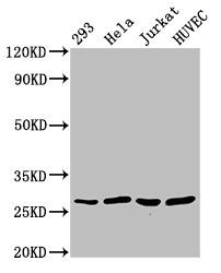 CACYBP Antibody