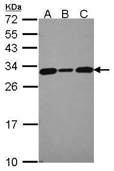 CacyBP antibody [N1C3]