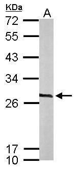 CacyBP antibody [N1C3]