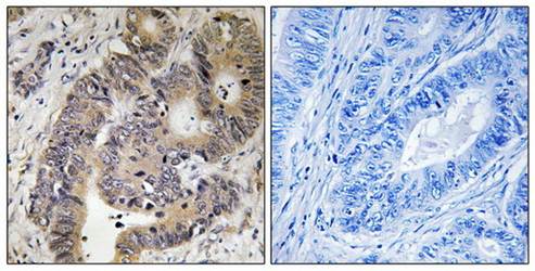 CAD (Phospho-Thr456) Antibody