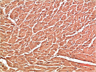 CDH5 Antibody