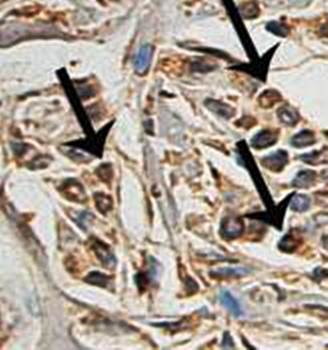 CAIX Rabbit Polyclonal Antibody