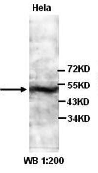 CAIX Rabbit Polyclonal Antibody