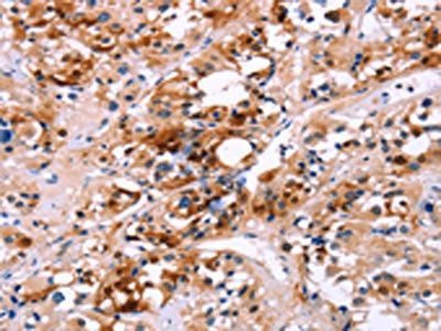 CALB1 Antibody