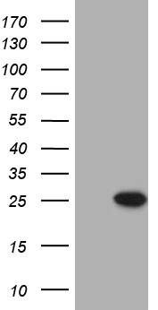 Calcium binding protein P22 Antibody