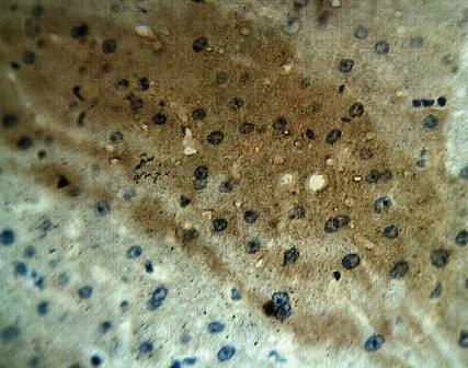 Rabbit Human Calcium Homeostasis Modulator Protein 1 Antibody