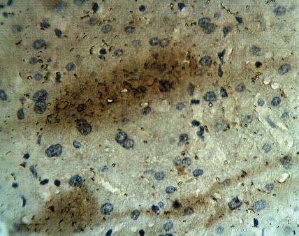 Rabbit Human Calcium Homeostasis Modulator Protein 1 Antibody