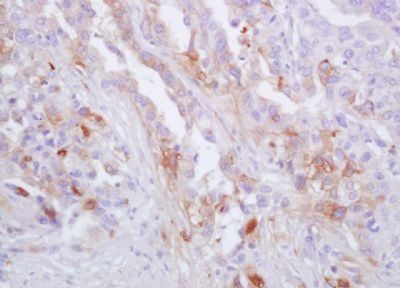 Calcium Sensing Receptor Rabbit Polyclonal Antibody