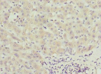 CALCOCO1 Antibody