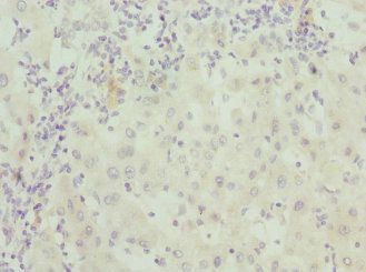 CALCOCO1 Antibody