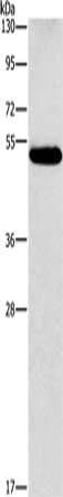 CALCRL Antibody