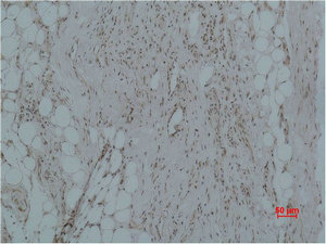 CALHM1 Antibody