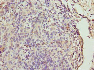 CALM1 Antibody