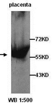 Calpain 6 Rabbit Polyclonal Antibody