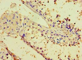 CALR3 Antibody