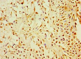 CALR3 Antibody