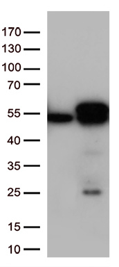 Calreticulin Antibody