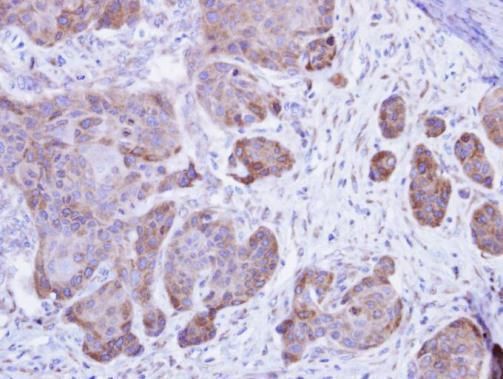 calsequestrin 2 Antibody