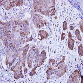 Calsequestrin-2 antibody
