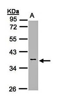 Calsequestrin-2 antibody