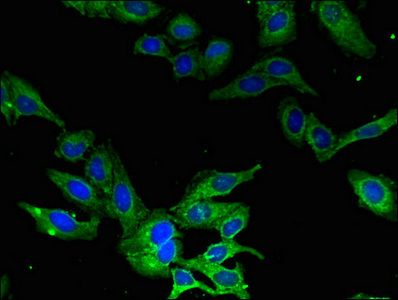 CAMK1 Antibody