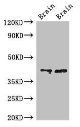 CAMK1 Antibody