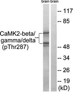 CaMK2-β/γ/δ (Phospho-Thr287) Antibody
