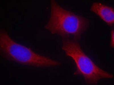 CAMK2A Antibody