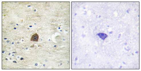 CaMK2α/β/δ (Phospho-Thr305) Antibody