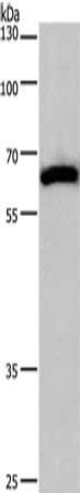CAMK4 Antibody