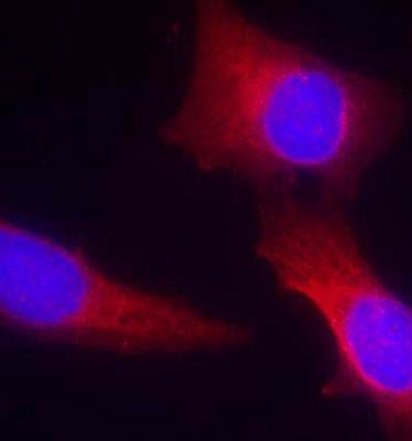 CaMKII (Ab-286) Antibody