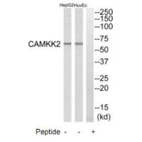 CAMKK2 Antibody