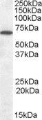 Cannabinoid Receptor 1 Antibody