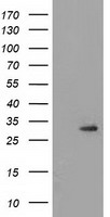 CAPZA1 Antibody