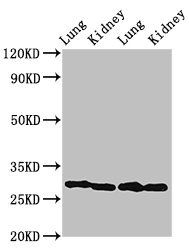 CA1 Antibody