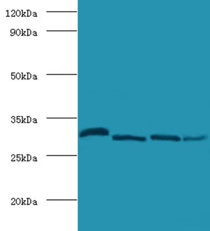 CA2 Antibody