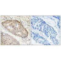 CARF Antibody