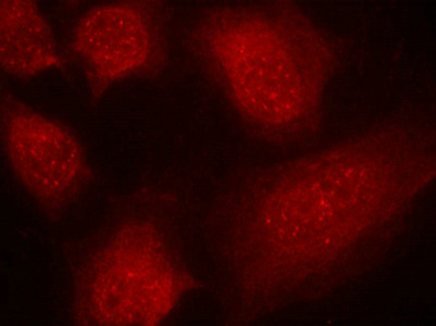 CARM1 Antibody
