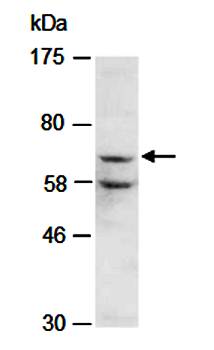 CARM1 (C) Antibody, Rabbit Polyclonal