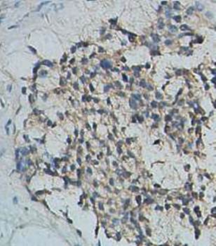 CARM1 Rabbit Polyclonal Antibody