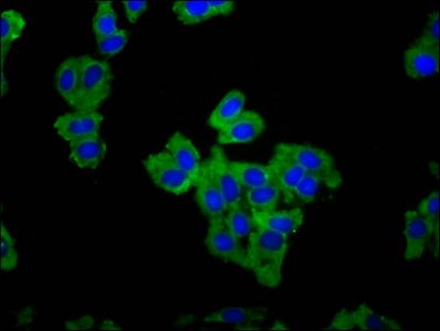 CARMIL1 Antibody