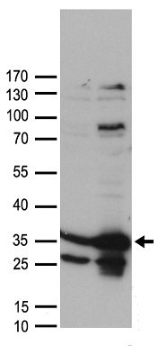 Casein Kinase 2 beta Antibody